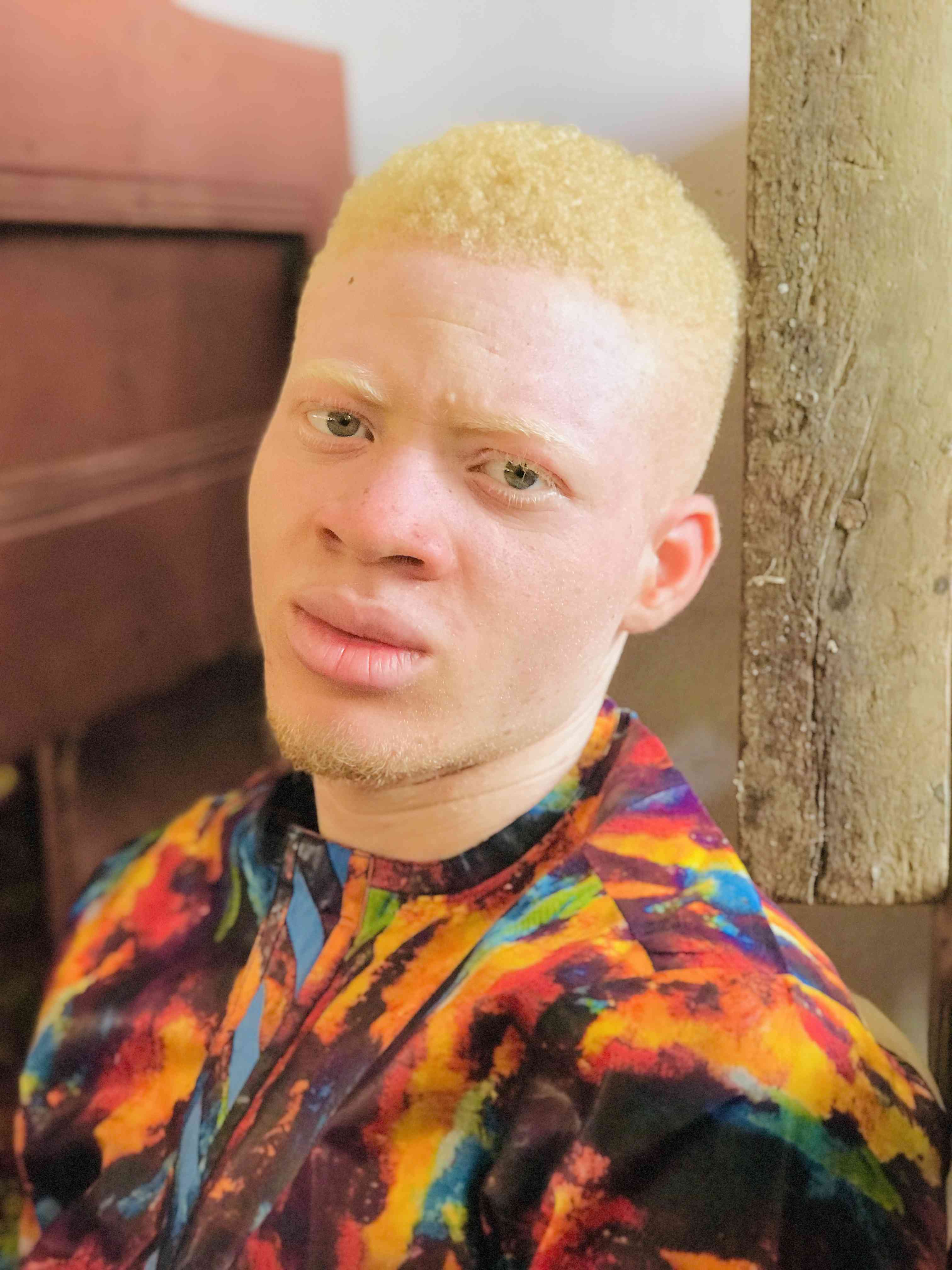 Finest Albino🔥❤️‍🔥 | MirrorLog