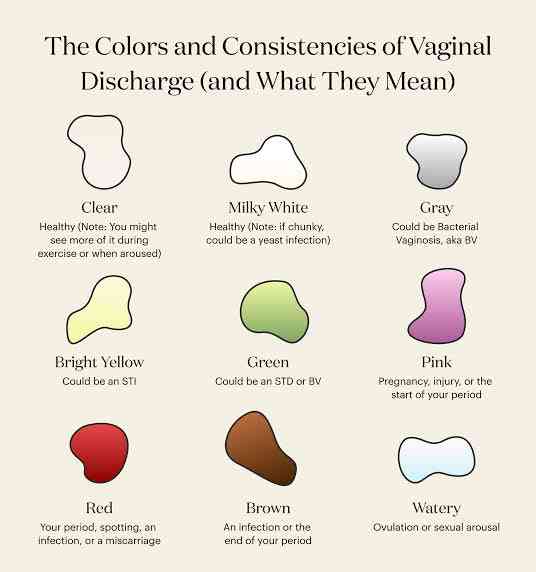 Colors Of Vaginal Discharge Mirrorlog Colors Of Vaginal Discharge Mirrorlog