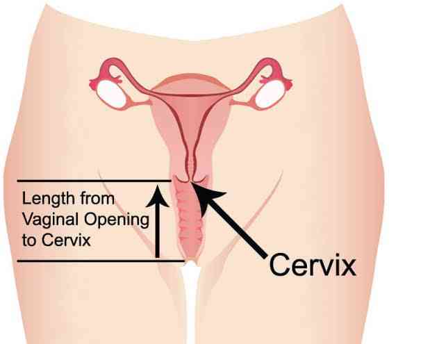 Cervix | MirrorLog
