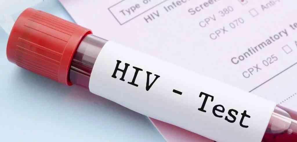 40 couple about to participate in mass wedding tested positive for HIV | MirrorLog